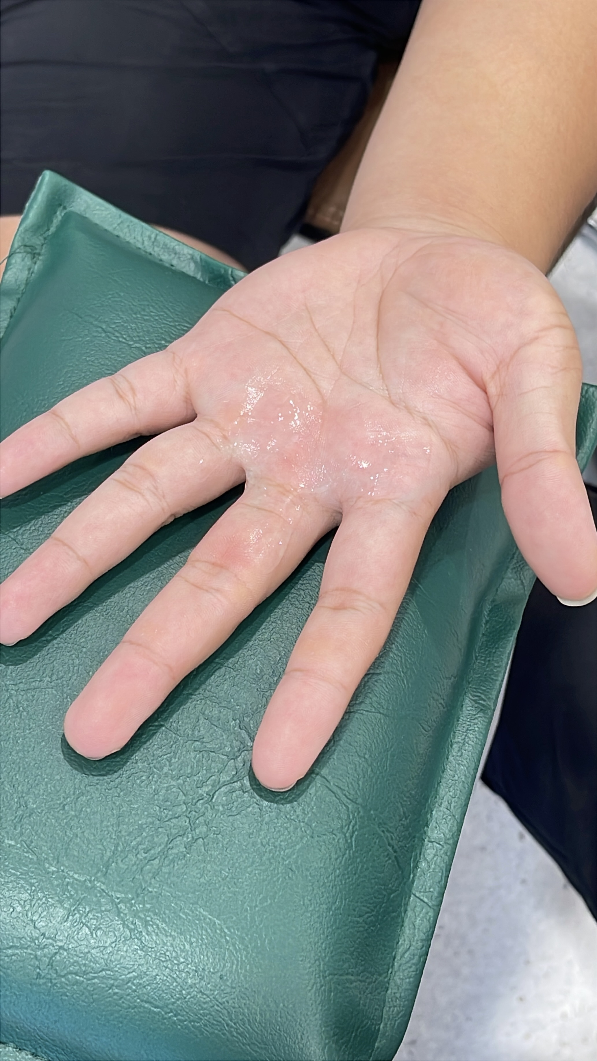 ชามือชาเท้าเกิดจากอะไร? คำตอบอาจมากกว่าที่คุณคิด
