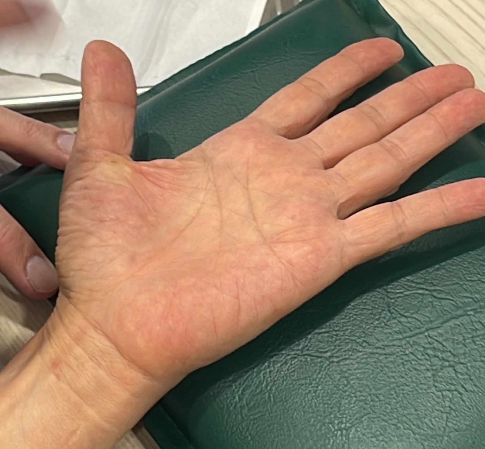 มือชา…เรื่องเล็กหรือสัญญาณอันตราย?