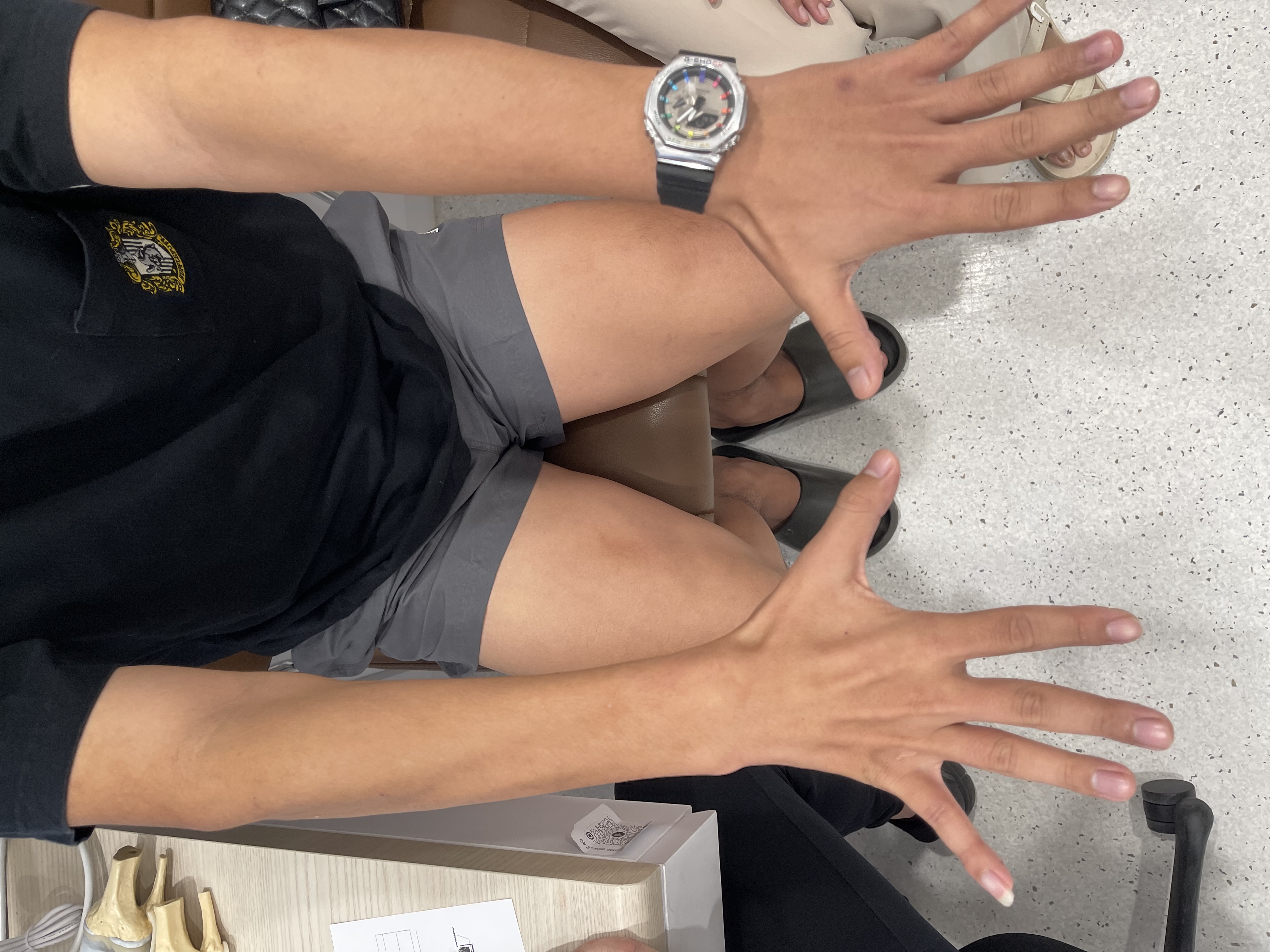มือไม่มีแรง กำของไม่ถนัด ชาที่ปลายแขน–มือข้างเดียว
