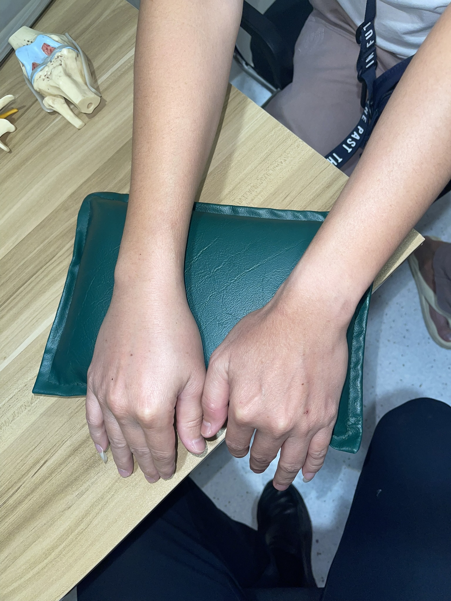 ข้อมือบวมเป่งเหมือน "นวมชกมวย" ทั้งที่ไม่ได้ไปต่อยใคร!