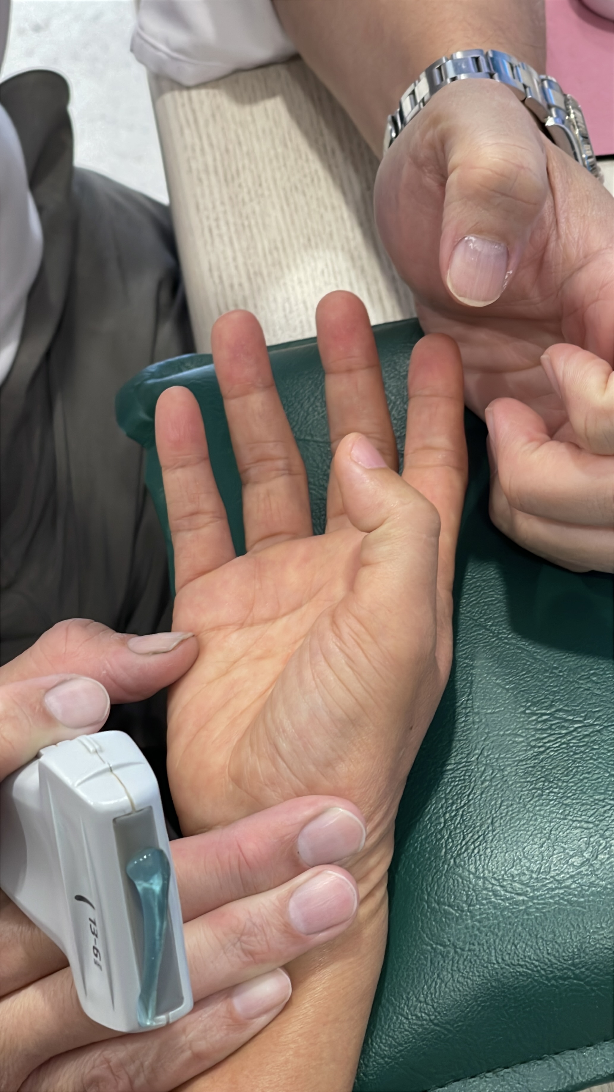 กำมือแล้วกางไม่ได้... นิ้วล็อกสะดุ้งปวด บอกลาการผ่าตัดด้วย 'เข็มสะกิด' ผ่านจออัลตราซาวด์"