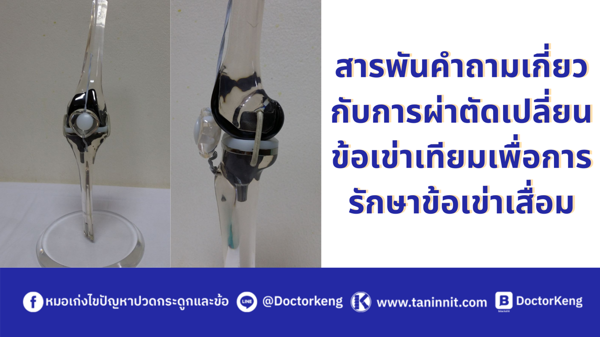 สารพันคำถามเกี่ยวกับการผ่าตัดเปลี่ยนข้อเข่าเทียมเพื่อการรักษาข้อเข่าเสื่อม