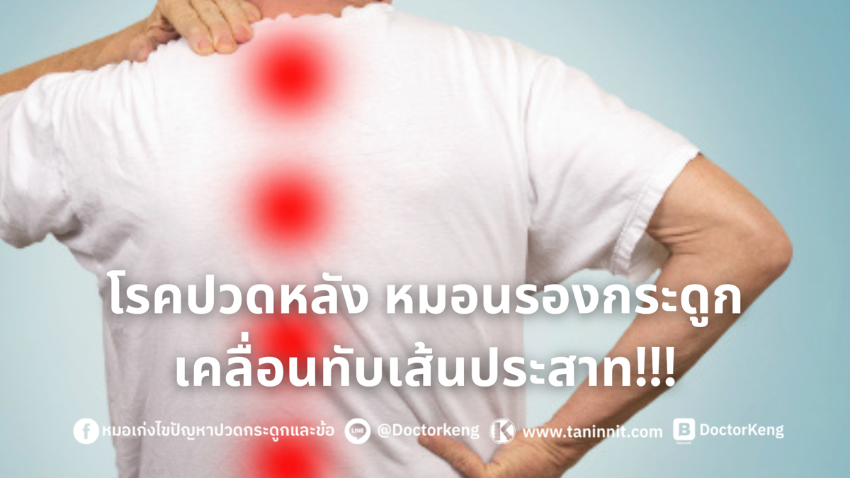 โรคปวดหลัง หมอนรองกระดูกเคลื่อนทับเส้นประสาท