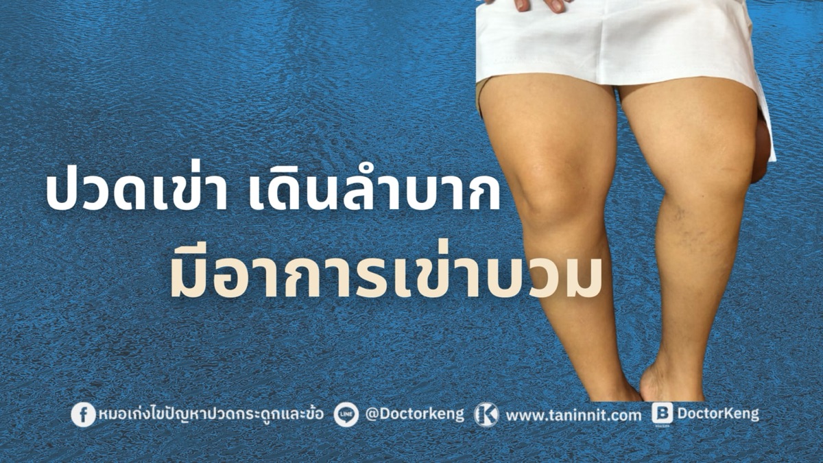ปวดเข่า เดินลำบาก มีอาการเข่าบวม